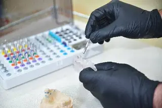 Yeremchuk Dental (ROYAL DENTAL), ПРОСТІР ЦИФРОВОЇ СТОМАТОЛОГІЇ ТА ІМПЛАНТАЦІЇ — фото 5