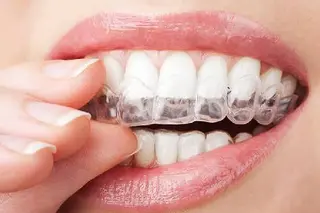 Стоматологія Respect Dental: сучасна стоматологічна клініка в Івано-Франківську — фото 4