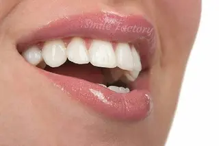 Стоматологія "Smile Factory" — фото 5