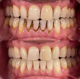 Стоматолог Ортодонт "LYSKO_DENTAL" — фото