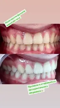 Стоматолог Ортодонт "LYSKO_DENTAL" — фото 3