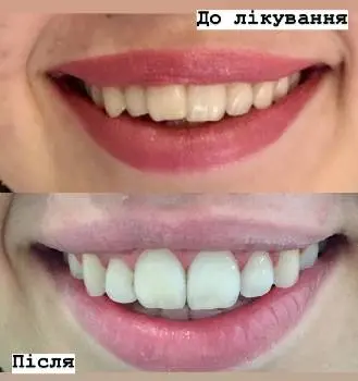 Стоматолог Ортодонт "LYSKO_DENTAL" — фото 4