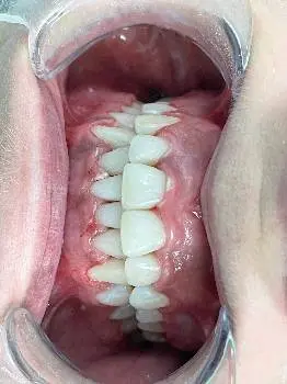 Стоматолог Ортодонт "LYSKO_DENTAL" — фото 5