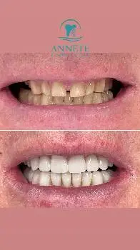 Стоматологічна клініка Annete dental clinic — фото