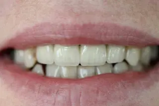 Стоматологія Dental Plus • Юрій Yurii Овсянецький — фото 4