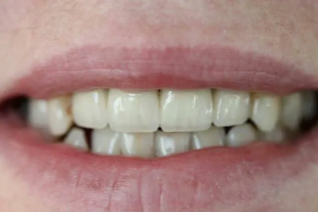 Стоматологія Dental Plus • Юрій Yurii Овсянецький — фото 4