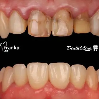 Центр стоматології Dental Line — фото 4