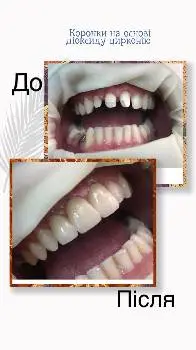 СтоматологіяDental VIT — фото