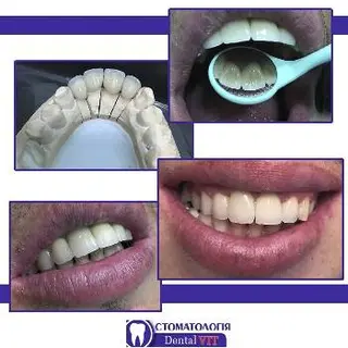 СтоматологіяDental VIT — фото 2