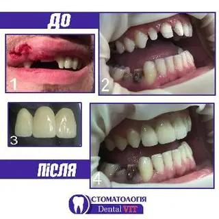 СтоматологіяDental VIT — фото 3
