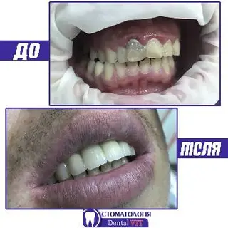 СтоматологіяDental VIT — фото 4