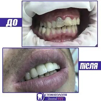 СтоматологіяDental VIT — фото 4