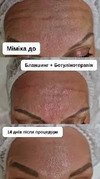 Косметолог Івано Франківськ Студія краси B.V.B.Cosmetic — фото 2