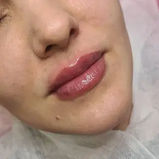 Косметолог Івано Франківськ Студія краси B.V.B.Cosmetic — фото 3