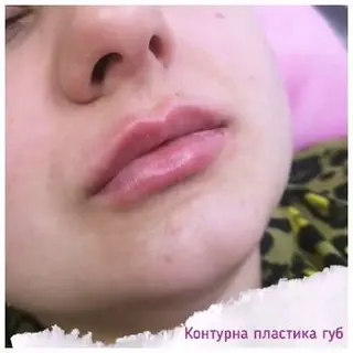 Косметолог Івано Франківськ Студія краси B.V.B.Cosmetic — фото 4