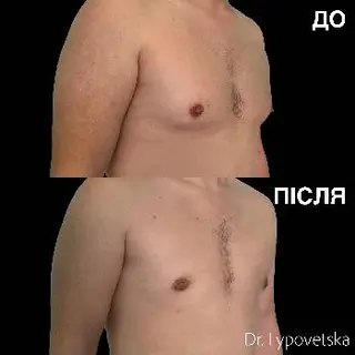Пластичний хірург Липовецька Тетяна — фото 4