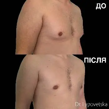 Пластичний хірург Липовецька Тетяна — фото 4