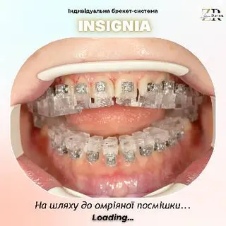 Ортодонт Дрогобич Zakhariia Dental Брекети — фото 5
