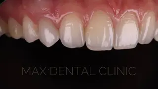 Max Dental Clinic — фото