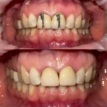 MIRA Dental (МІРА Дентал Стоматологія) — фото 2