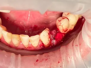 MIRA Dental (МІРА Дентал Стоматологія) — фото 3