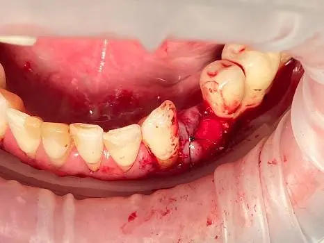 MIRA Dental (МІРА Дентал Стоматологія) — фото 3