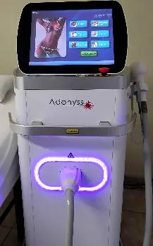 Лазерна епіляція Laser Touch — фото 3