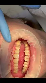 Стоматологія Др.Ірена Пшик-Тітко, к.мед.н. Dental private practice. Dr. Irena Pshyk-Titko PhD — фото 2