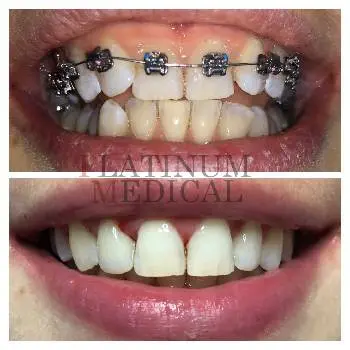 Platinum Medical клініка ортодонтії та стоматології — фото 3