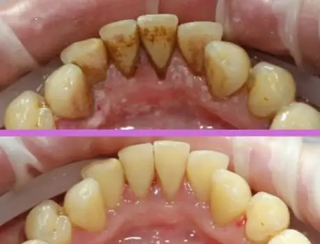 Стоматологія у Львові Доvira Dental Clinic — фото 4