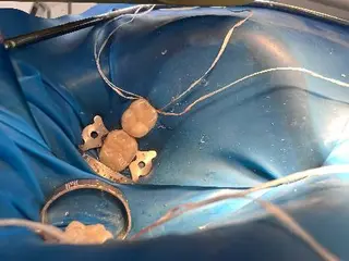 Стоматолог у Львові Харатін Олег Степанович — фото 5