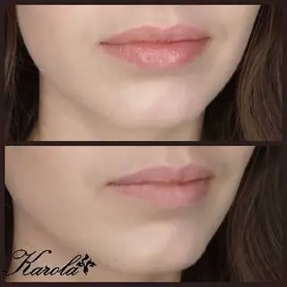 Cosmetology secrets: косметолог без уколів, масаж, депіляція шугаринг і віск, електроепіляція, тейпи • Львів — фото 2