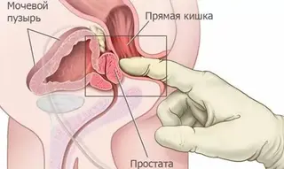 Масажист Львів. Професійний масаж у Львові на дому. — фото 2