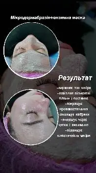 Косметолог Валерія Гузар — фото 5