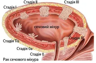 Кепич Ярослав Миколайович, уролог вищої категорії, онкоуролог, Львів — фото 3