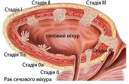 Кепич Ярослав Миколайович, уролог вищої категорії, онкоуролог, Львів — фото 3