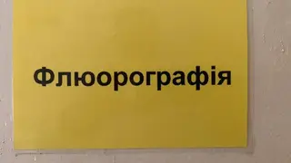 Флюорографія Цифрова рентгенографія легень Chest X-ray — фото