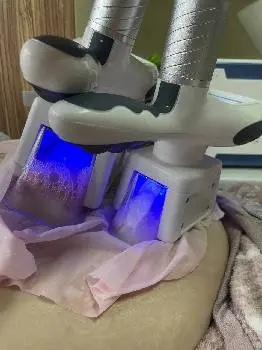 Flat Laser -Лазерна епіляція.Ботокс.Пластика . — фото 4